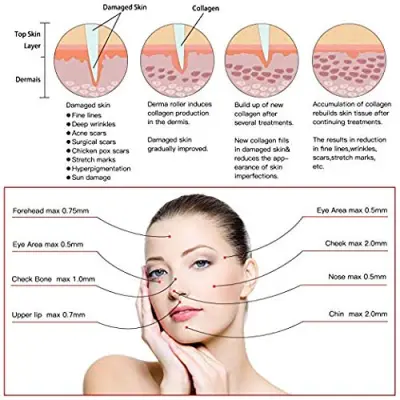 Dr. Pen M5 قلم ديرما احترافي بنظام الإبرة الدقيقة الأوتوماتيكي – أطوال إبر قابلة للتعديل لعلاجات البشرة المتقدمة - صورة إضافية