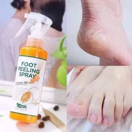 اسبراي