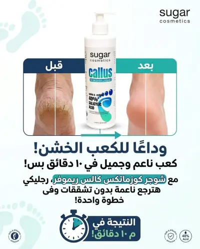 كالس اوف مزيل الجلد الميت عبوة نص لتر - صورة إضافية