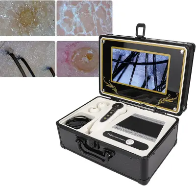 جهاز تحليل فروة الرأس والشعر والجلد 50X/200X بشاشة LCD 7 بوصة – Scalp & Hair Analyzer - صورة إضافية